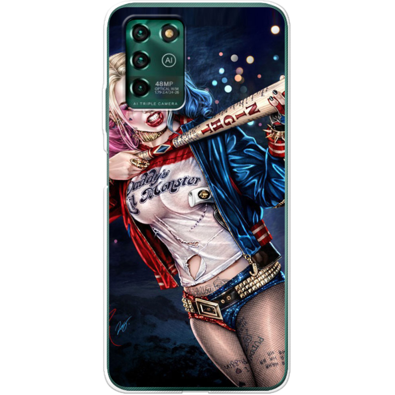 Чехол BoxFace ZTE Blade V30 Vita Harley Quinn