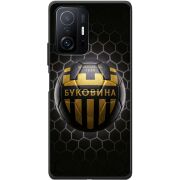 Черный чехол BoxFace Xiaomi 11T / 11T Pro 