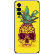 Чехол BoxFace Tecno Camon 18 / 18P Pineapple Skull