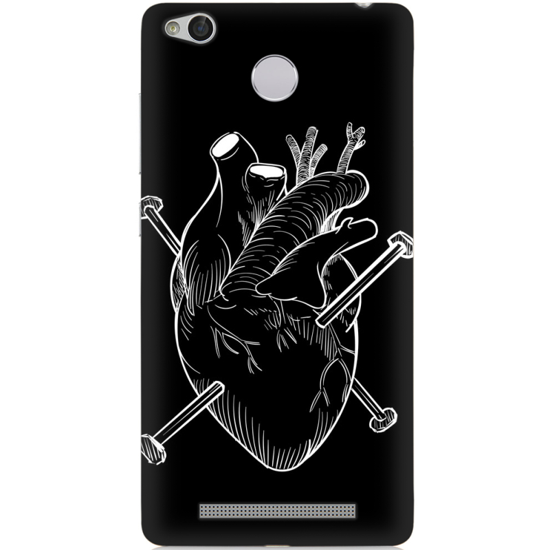 Чехол Uprint Xiaomi Redmi 3x 