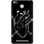 Чехол Uprint Xiaomi Redmi 3x 