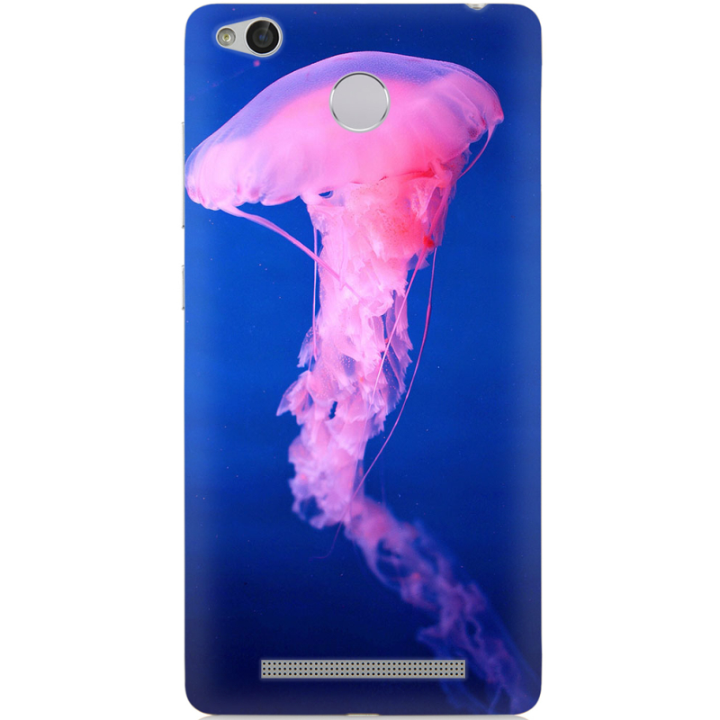 Чехол Uprint Xiaomi Redmi 3x 