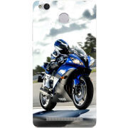 Чехол Uprint Xiaomi Redmi 3x 