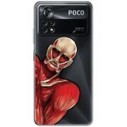 Прозрачный чехол BoxFace Xiaomi Poco X4 Pro 5G Титан