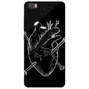 Чехол Uprint Xiaomi Mi 5s 