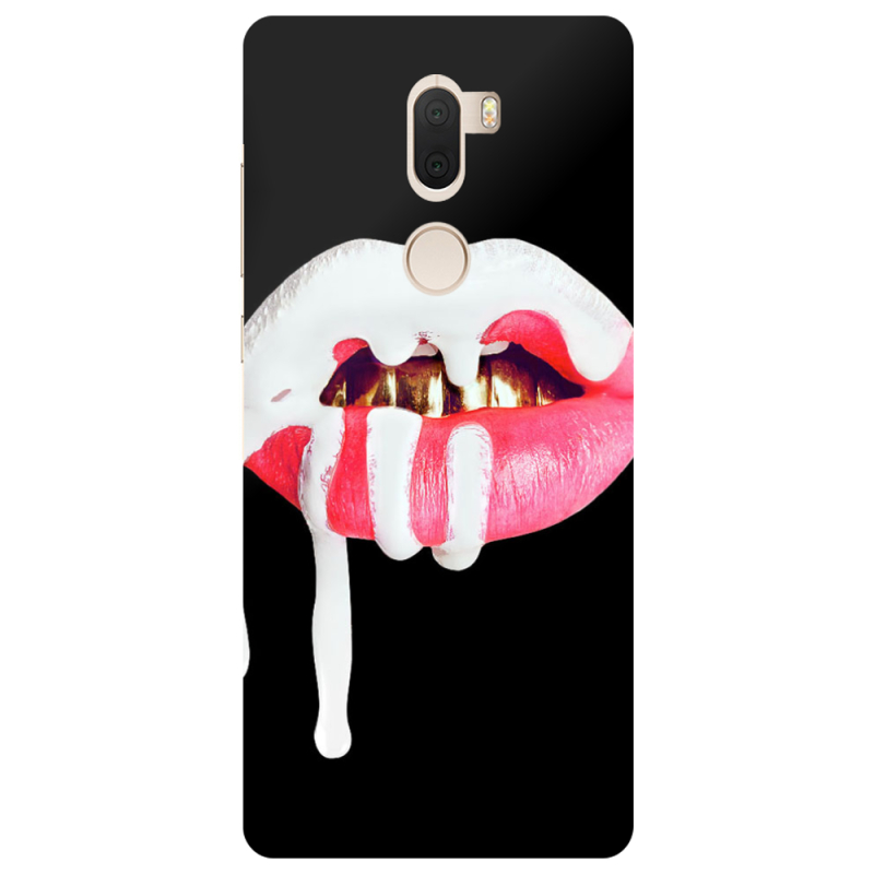 Чехол Uprint Xiaomi Mi 5s Plus 