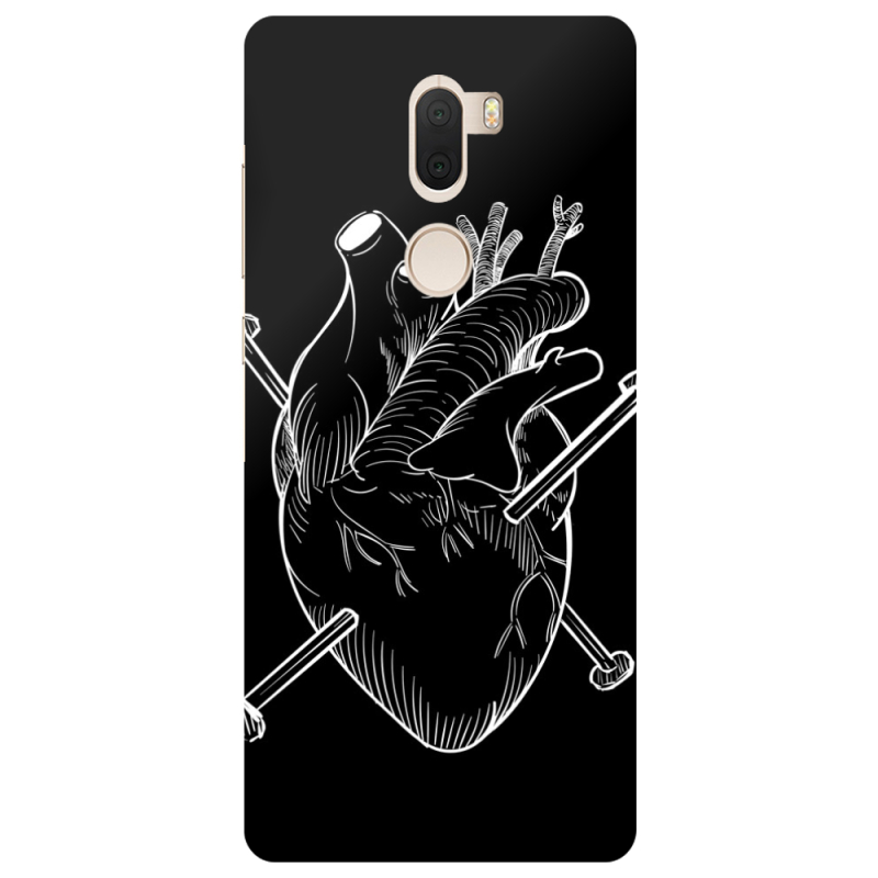 Чехол Uprint Xiaomi Mi 5s Plus 