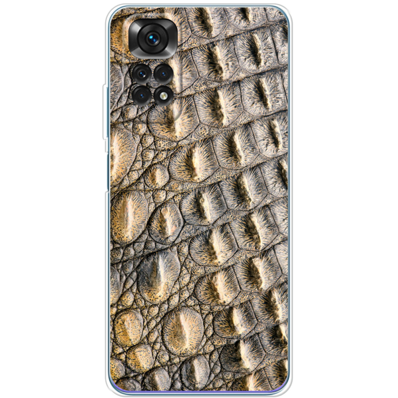 Чехол BoxFace Xiaomi Redmi Note 11 / Note 11S Global Version 