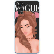 Чехол BoxFace Xiaomi Redmi Note 11 / Note 11S Global Version Fashion Girl