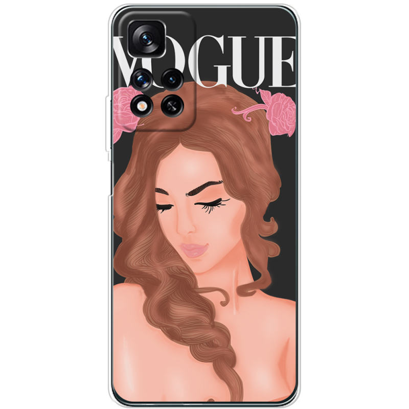 Чехол BoxFace Xiaomi Redmi Note 11 Pro Plus 5G Global Version Fashion Girl