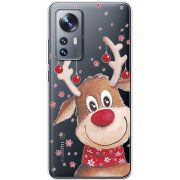 Прозрачный чехол BoxFace Xiaomi 12 / 12X Winter Deer