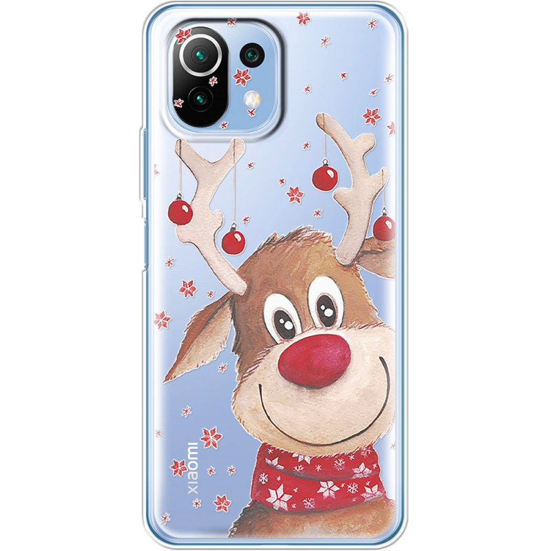 Прозрачный чехол BoxFace Xiaomi Mi 11 Lite Winter Deer