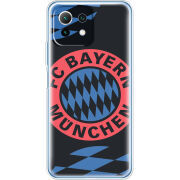 Чехол BoxFace Xiaomi Mi 11 Lite FC Bayern