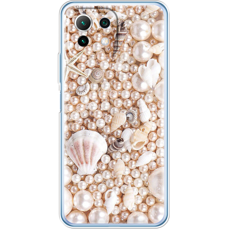 Чехол BoxFace Xiaomi Mi 11 Lite 