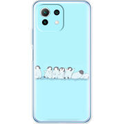 Чехол BoxFace Xiaomi Mi 11 Lite 
