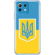 Чехол BoxFace Xiaomi Mi 11 Lite Герб України