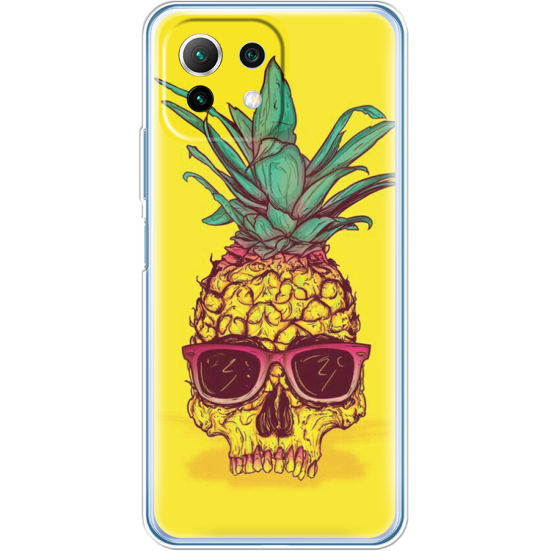 Чехол BoxFace Xiaomi Mi 11 Lite Pineapple Skull