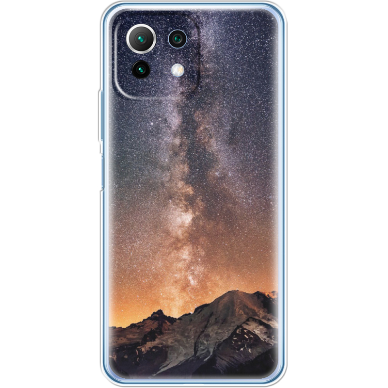 Чехол BoxFace  Xiaomi 11 Lite 5G NE 