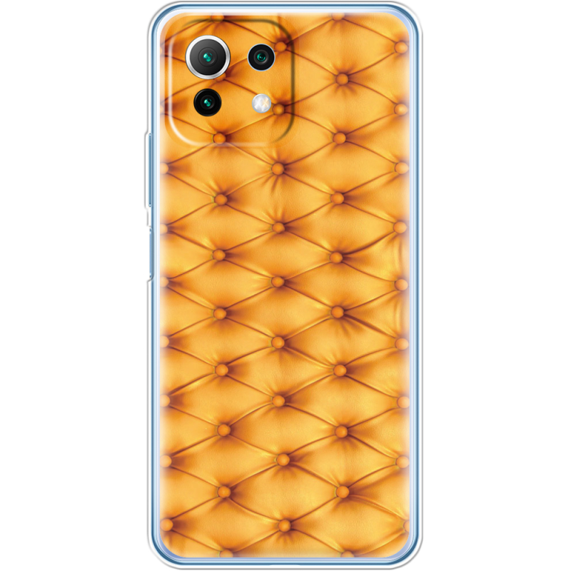 Чехол BoxFace  Xiaomi 11 Lite 5G NE 