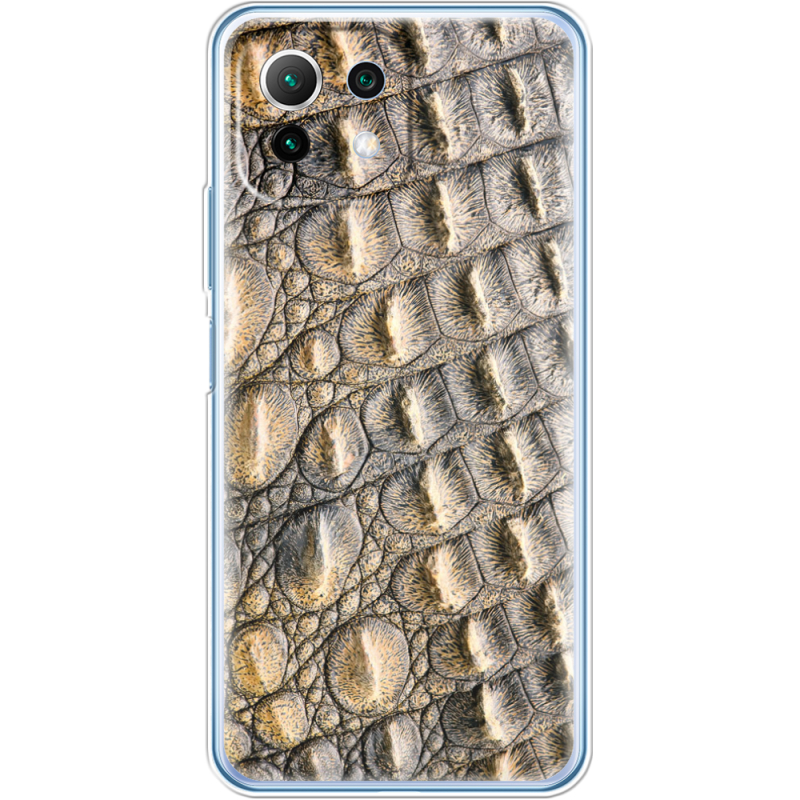 Чехол BoxFace  Xiaomi 11 Lite 5G NE 