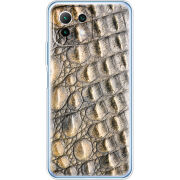 Чехол BoxFace  Xiaomi 11 Lite 5G NE 