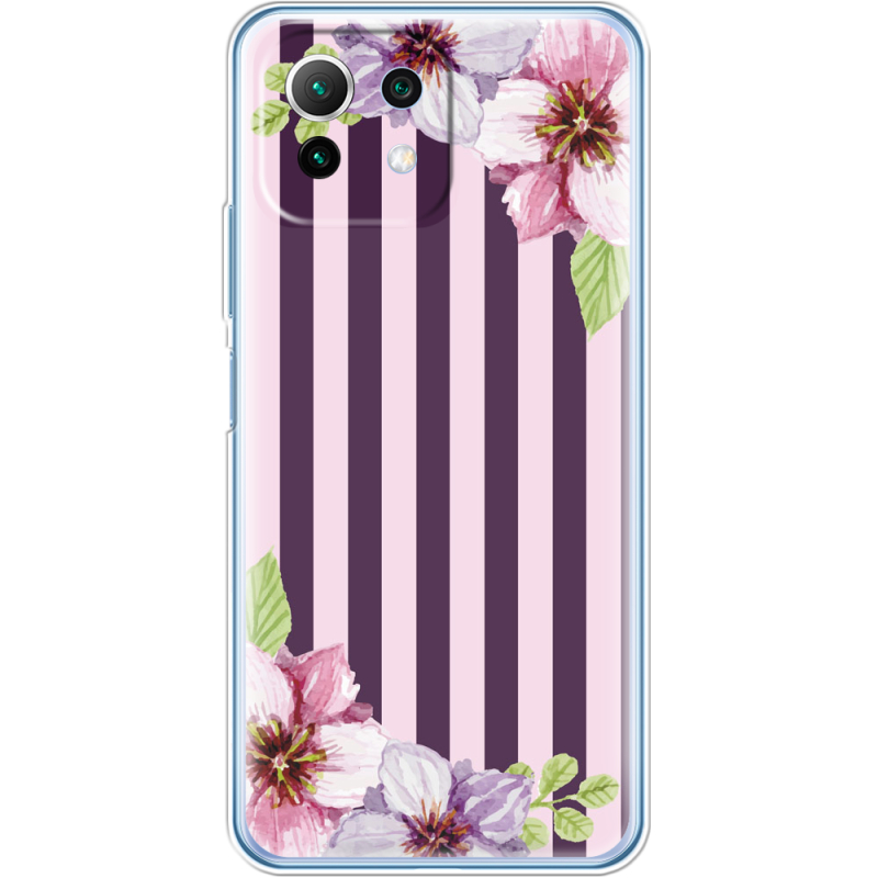 Чехол BoxFace  Xiaomi 11 Lite 5G NE Purple Fantasy
