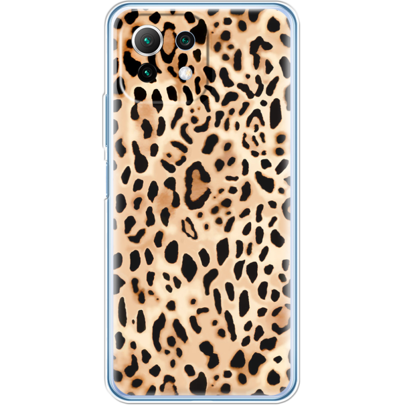 Чехол BoxFace  Xiaomi 11 Lite 5G NE 