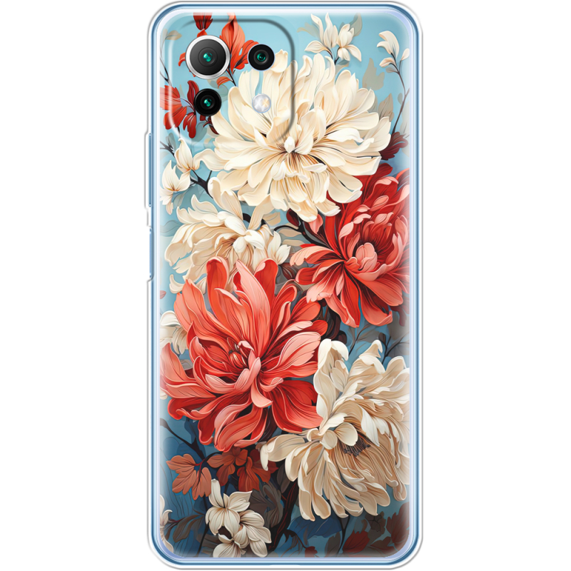Чехол BoxFace  Xiaomi 11 Lite 5G NE 