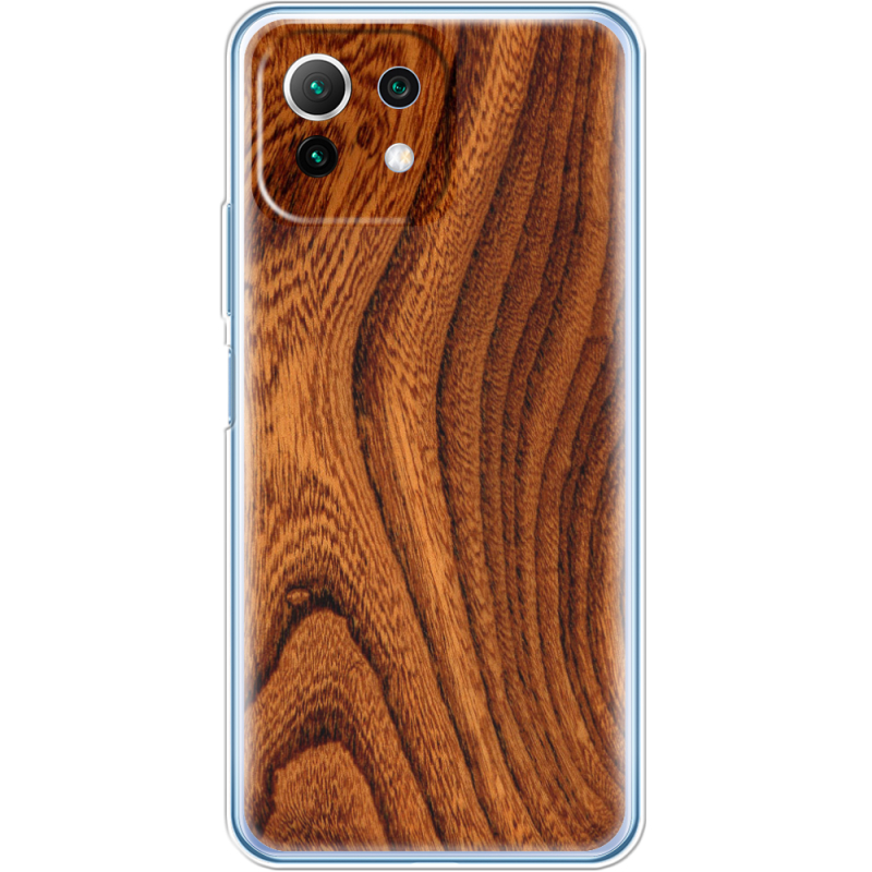 Чехол BoxFace  Xiaomi 11 Lite 5G NE 
