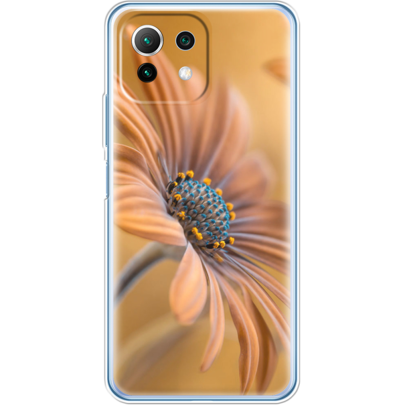 Чехол BoxFace  Xiaomi 11 Lite 5G NE 