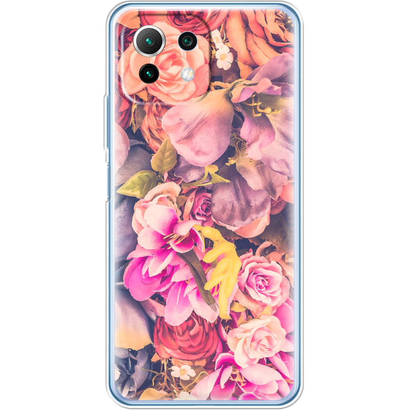 Чехол BoxFace  Xiaomi 11 Lite 5G NE 