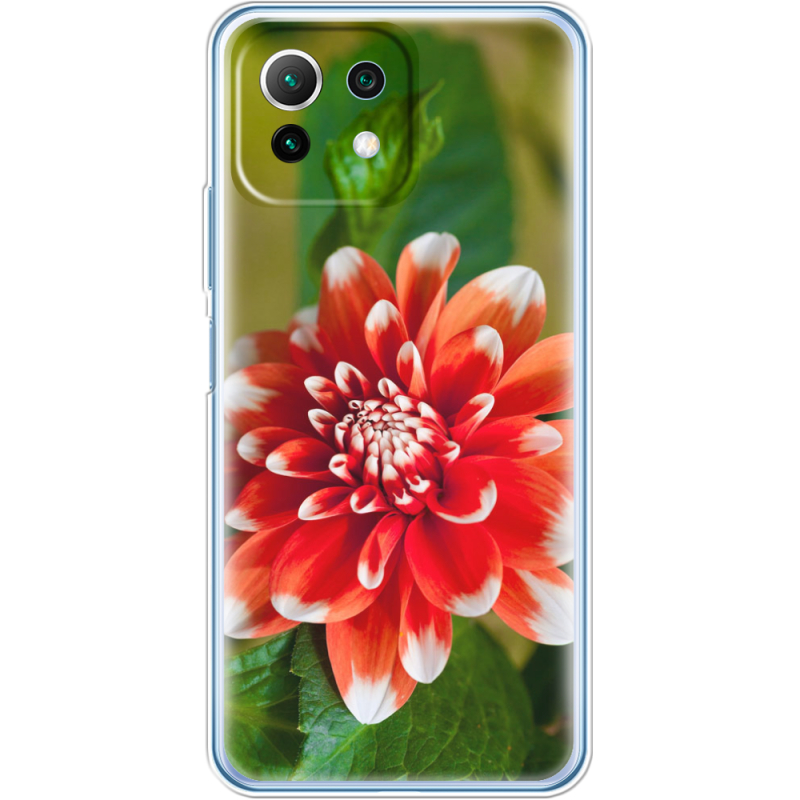 Чехол BoxFace  Xiaomi 11 Lite 5G NE 