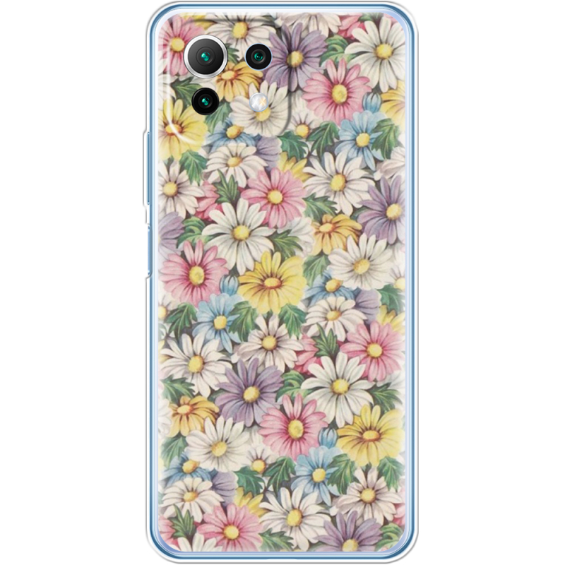 Чехол BoxFace  Xiaomi 11 Lite 5G NE 