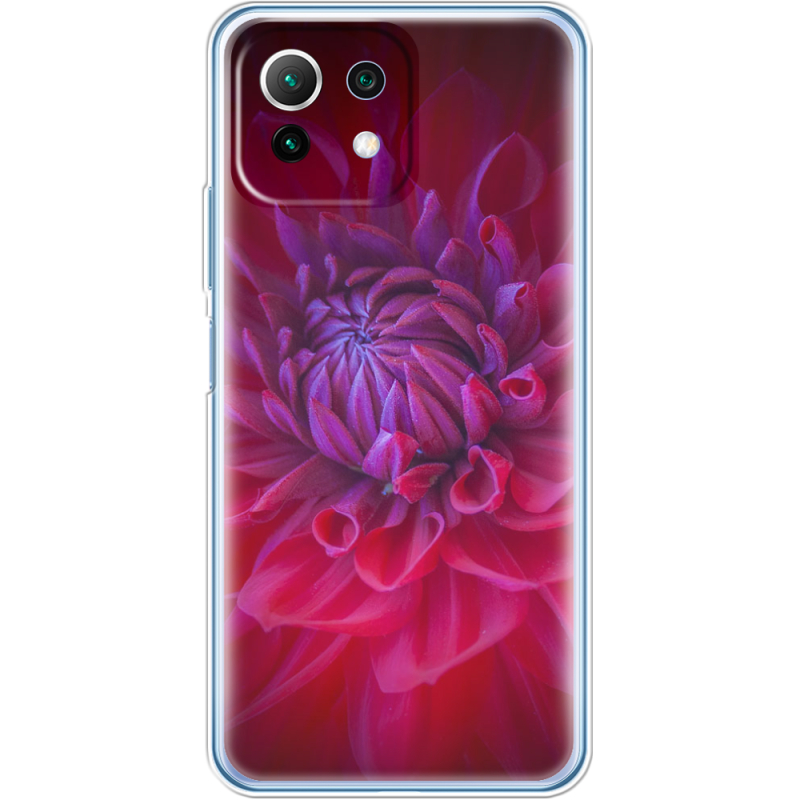 Чехол BoxFace  Xiaomi 11 Lite 5G NE 