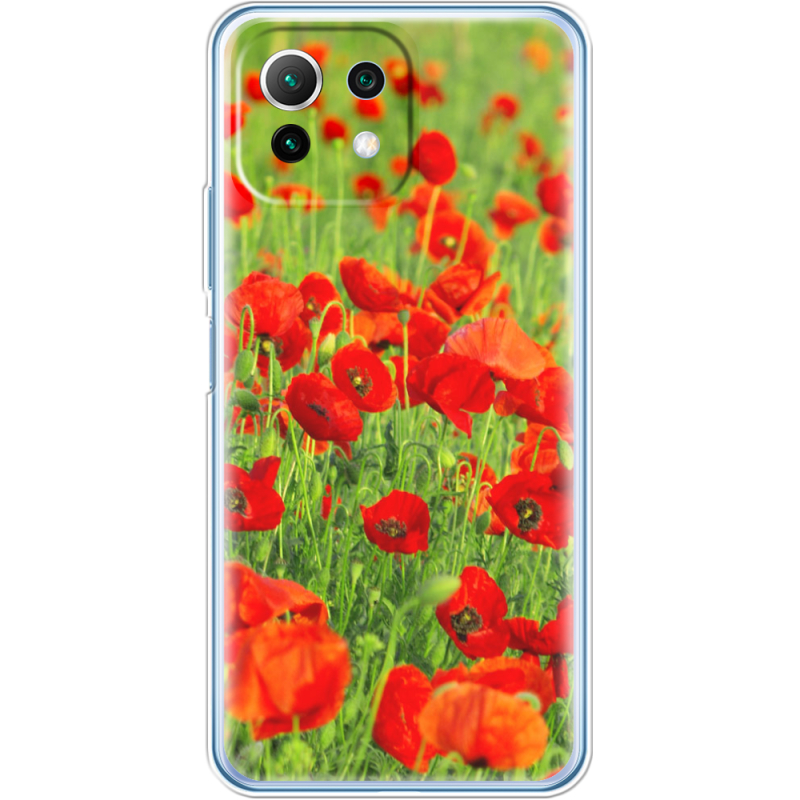 Чехол BoxFace  Xiaomi 11 Lite 5G NE 
