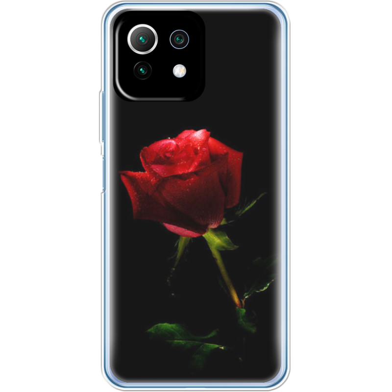 Чехол BoxFace  Xiaomi 11 Lite 5G NE 