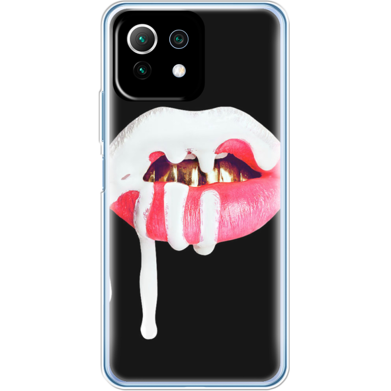 Чехол BoxFace  Xiaomi 11 Lite 5G NE 