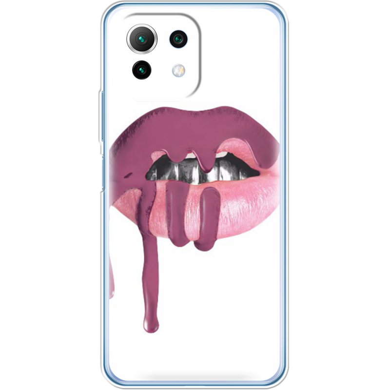 Чехол BoxFace  Xiaomi 11 Lite 5G NE 