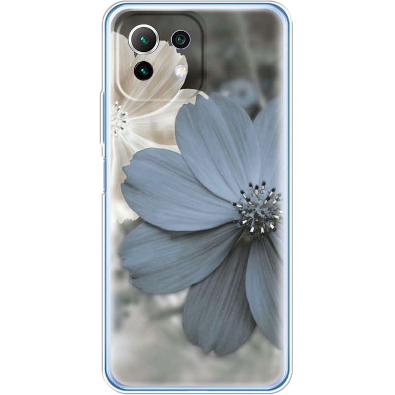 Чехол BoxFace  Xiaomi 11 Lite 5G NE 
