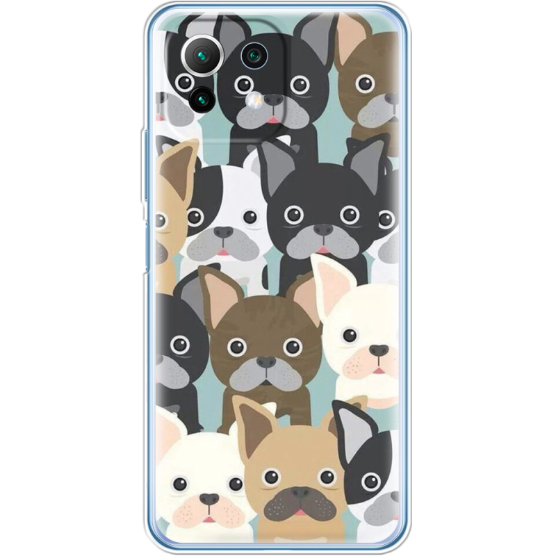 Чехол BoxFace  Xiaomi 11 Lite 5G NE 
