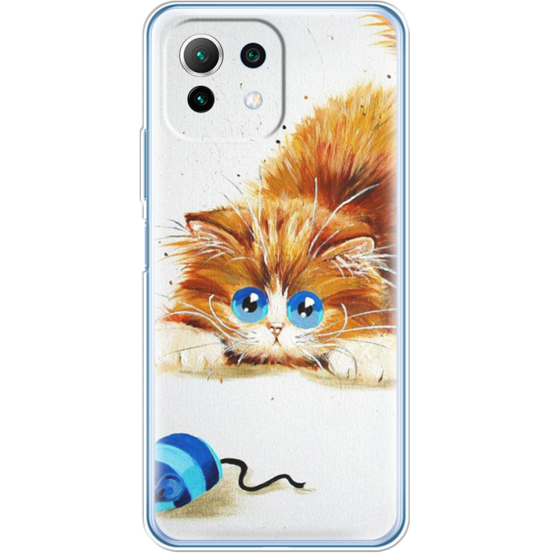 Чехол BoxFace  Xiaomi 11 Lite 5G NE 