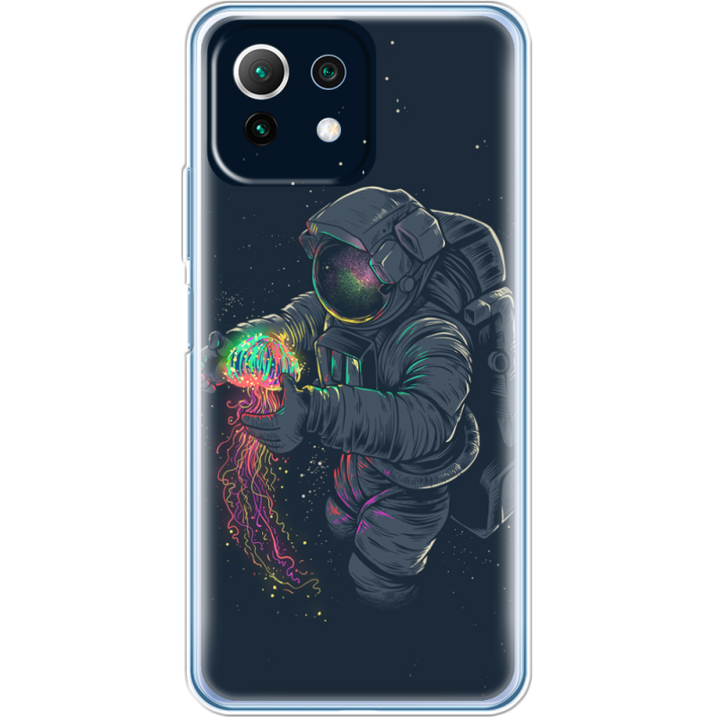 Чехол BoxFace  Xiaomi 11 Lite 5G NE 