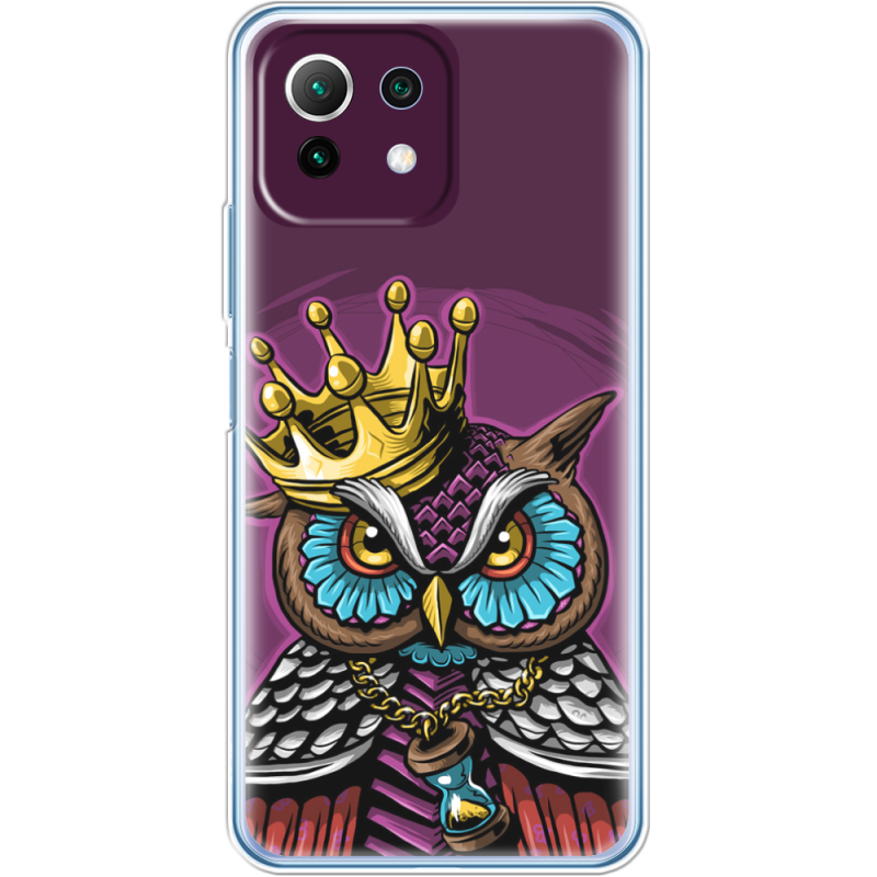 Чехол BoxFace  Xiaomi 11 Lite 5G NE 
