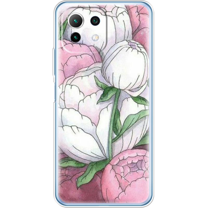 Чехол BoxFace  Xiaomi 11 Lite 5G NE 