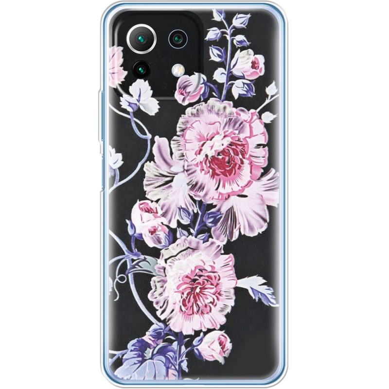 Чехол BoxFace  Xiaomi 11 Lite 5G NE 