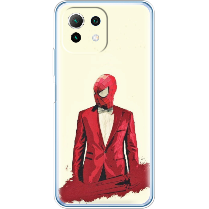 Чехол BoxFace  Xiaomi 11 Lite 5G NE 
