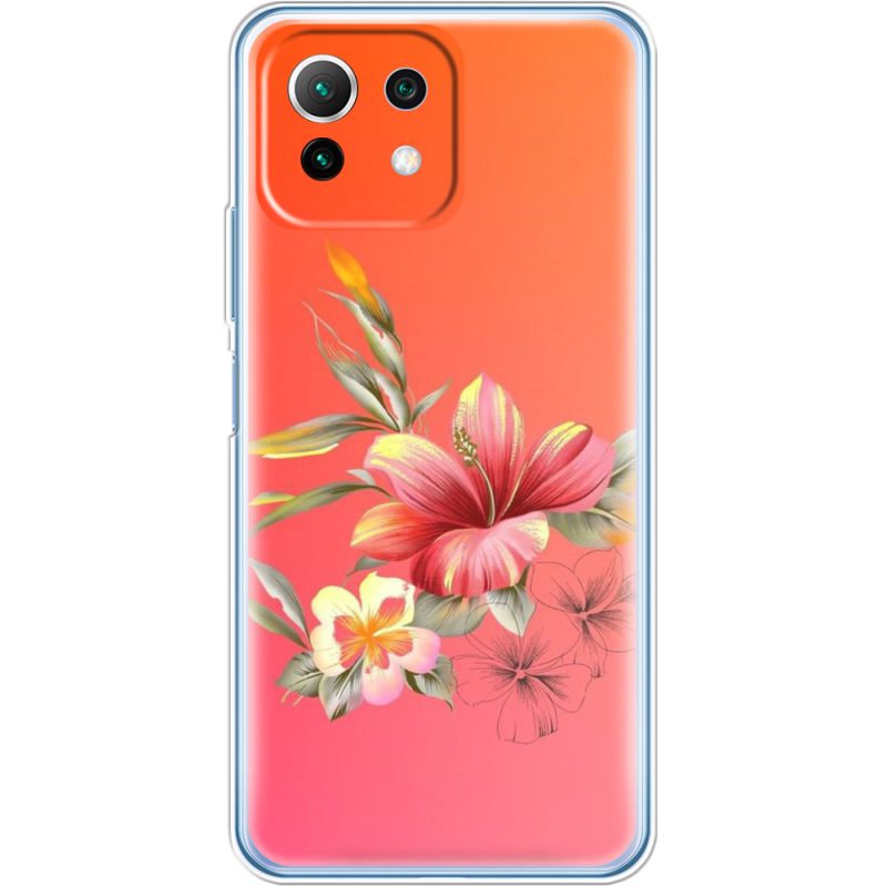 Чехол BoxFace  Xiaomi 11 Lite 5G NE 