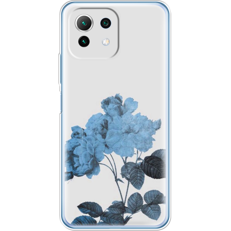Чехол BoxFace  Xiaomi 11 Lite 5G NE 
