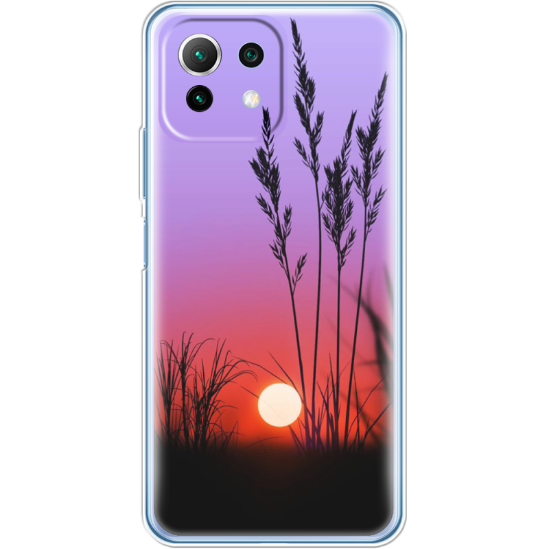 Чехол BoxFace  Xiaomi 11 Lite 5G NE 