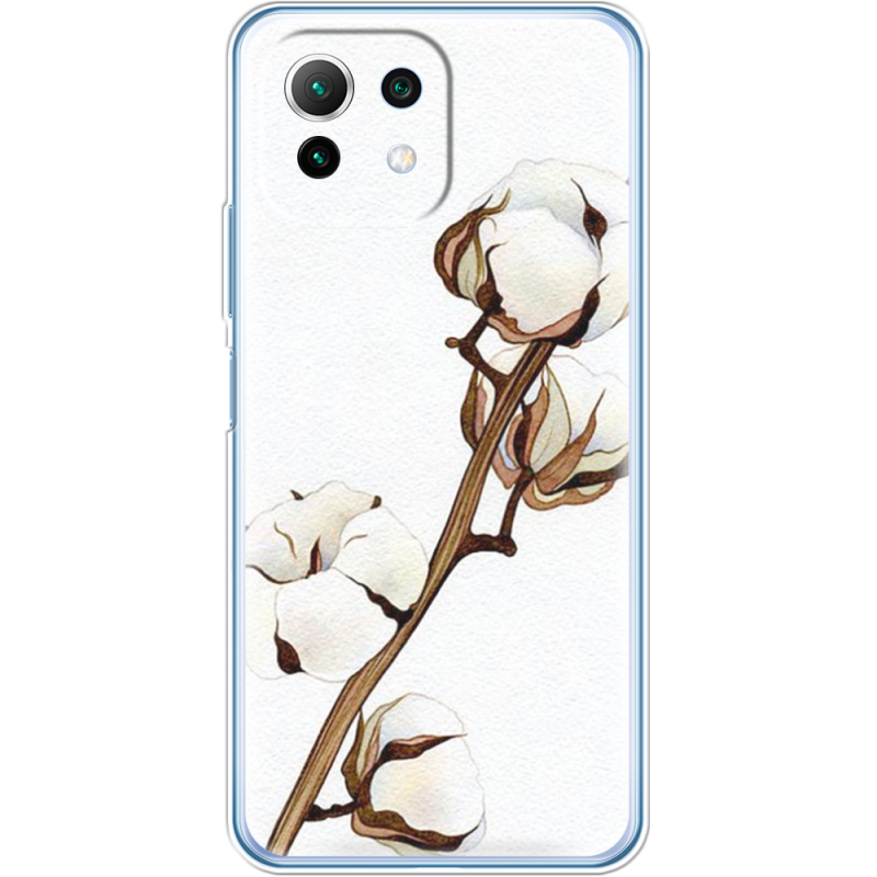 Чехол BoxFace  Xiaomi 11 Lite 5G NE 